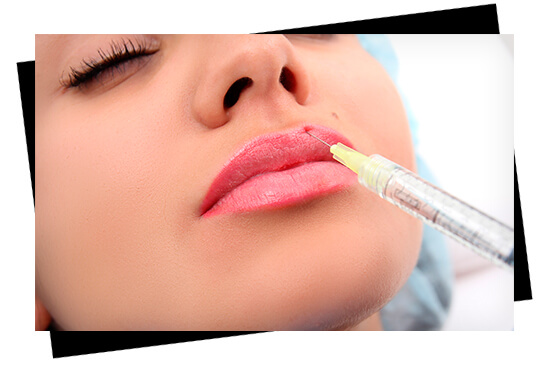 Lip Correction Surgery