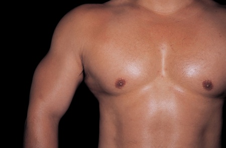 Gynecomastia Surgery/ Male Chest Fat Reduction Surgery